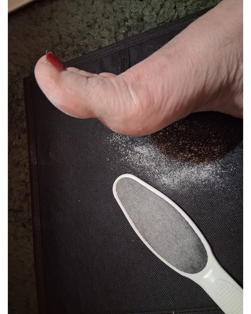 Hornhaut - abgehobelt